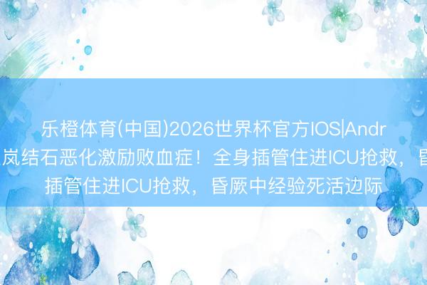 乐橙体育(中国)2026世界杯官方IOS|Android手机app下载 温岚结石恶化激励败血症！全身插管住进ICU抢救，昏厥中经验死活边际
